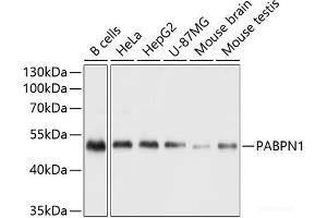 Western blot analysis of extracts of various cell lines using Polyclonal AntibodyPN1 Polyclonal Antibody at dilution of 1:1000. (PN1 Antikörper)