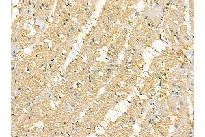 ABIN6264842 and ABIN6279051 at 1/100 staining rat heart tissue by IHC-P.