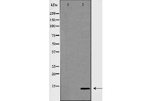 Western blot analysis of INSL3 expression in MCF7 cells,The lane on the left is treated with the antigen-specific peptide. (INSL3 Antikörper  (Internal Region))