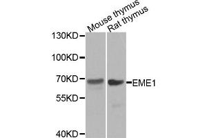 Western blot analysis of extracts of mouse thymus and rat thymus tissues, using EME1 antibody. (Crossover junction endonuclease EME1 (EME1) Antikörper)