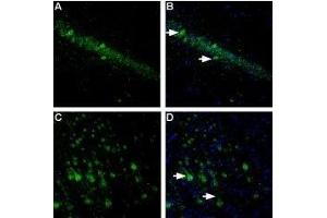 Expression of NLGN1 in rat hippocampus and cortexImmunohistochemical staining of free floating frozen section of rat hippocampal CA1 region (A, B) and rat parietal cortex (C, D) using Anti-Neuroligin 1 (extracellular) Antibody (ABIN7043361, ABIN7044680 and ABIN7044681), (1:300). (Neuroligin 1 (NLGN1) Peptid)
