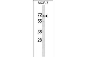 Western blot analysis in MCF-7 cell line lysates (35ug/lane). (PRAMEF2 Antikörper  (C-Term))