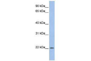 UBE2M antibody used at 1 ug/ml to detect target protein. (UBE2M Antikörper)