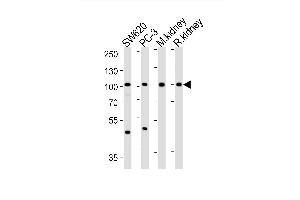 Western Blotting (WB) image for anti-Suppressor of Var1, 3-Like 1 (SUPV3L1) (AA 93-121), (N-Term) antibody (ABIN1881857)