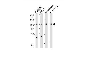 Western blot analysis of lysates from S, PC-3 cell line, mouse kidney, rat kidney tissue lysate (from left to right), using SUPV3L1 Antibody (N-term) (ABIN1881857 and ABIN2843036). (SUPV3L1 Antikörper  (N-Term))