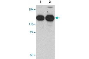 Western blot analysis of ZMYM2 in EL4 cell lysate with ZMYM2 polyclonal antibody  at (1) 0.