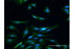 Immunofluorescence of purified MaxPab antibody to PADI4 on HeLa cell.