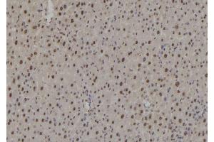 ABIN6276941 at 1/100 staining Rat liver tissue by IHC-P. (RAD9A Antikörper  (C-Term))