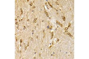 Immunohistochemistry of paraffin-embedded mouse brain using APLP1 antibody at dilution of 1:200 (400x lens). (APLP1 Antikörper)