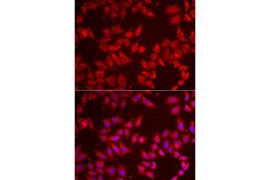Immunofluorescence analysis of HeLa cell using BAP1 antibody. (BAP1 Antikörper)