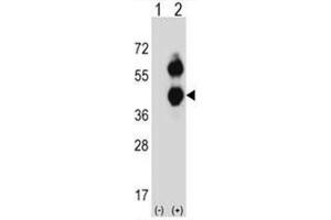 Western blot analysis of BCAT2 (arrow) using rabbit polyclonal BCAT2 Antibody (C-term) . (BCAT2 Antikörper  (C-Term))