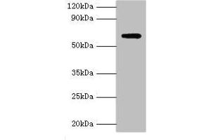 Western blot All lanes: Anti-Muellerian hormone type-2 receptor antibody at 15 μg/mL + Mouse brain tissue Secondary Goat polyclonal to rabbit IgG at 1/10000 dilution Predicted band size: 63, 53, 52 kDa Observed band size: 63 kDa (AMHR2 Antikörper  (AA 18-149))