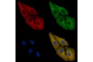 SOD1 Mouse Monoclonal Antibody staining Hela cells by IF/ICC.