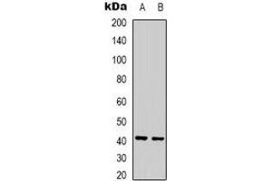 Western blot analysis of Ghrelin Receptor expression in Jurkat (A), rat liver (B) whole cell lysates. (GHSR Antikörper)