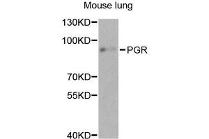 Western blot analysis of extracts of mouse lung, using PGR antibody.