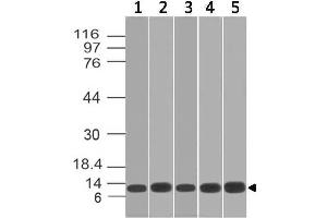 Image no. 1 for anti-S100 Calcium Binding Protein A8 (S100A8) antibody (ABIN5026984) (S100A8 Antikörper)