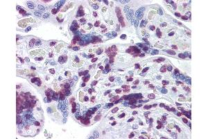 Anti-RBM5 antibody IHC of human placenta. (RBM5 Antikörper  (AA 75-184))