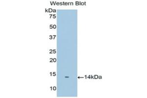Western Blotting (WB) image for anti-Prostate Stem Cell Antigen (PSCA) (AA 22-123) antibody (ABIN1175802) (PSCA Antikörper  (AA 22-123))
