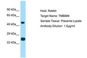 TMBIM4 抗体  (AA 110-159)