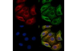 ABIN6263822 and ABIN6272378 staining Hela cells by IF/ICC. (OMG Antikörper  (Internal Region))