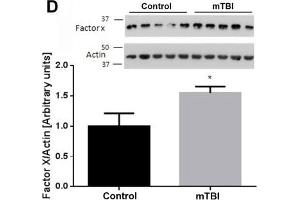 At two weeks upon injury, brain thrombin activity and concentration are similar between mTBI exposed animals and controls. (Factor 10 Heavy Chain (AA 351-448) Antikörper)