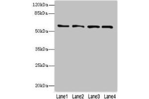 Western blot All lanes: FLAD1 antibody at 4 μg/mL Lane 1: K562 whole cell lysate Lane 2: HepG2 whole cell lysate Lane 3: MDA-MB-231 whole cell lysate Lane 4: Hela whole cell lysate Secondary Goat polyclonal to rabbit IgG at 1/10000 dilution Predicted band size: 66, 55, 50, 33, 37 kDa Observed band size: 66 kDa (FAD Synthetase Antikörper  (AA 1-490))