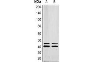 Western blot analysis of ERK1/2 (pY222/205) expression in MCF7 (A), Jurkat (B) whole cell lysates. (ERK1/2 Antikörper  (pTyr205, pTyr222))