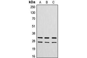 Western blot analysis of Cathepsin G expression in A549 (A), MCF7 (B), rat heart (C) whole cell lysates. (Cathepsin G Antikörper  (N-Term))