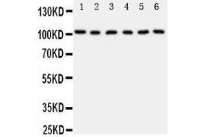 Western Blotting (WB) image for anti-Minichromosome Maintenance Complex Component 2 (MCM2) (AA 884-904), (C-Term) antibody (ABIN3044274)