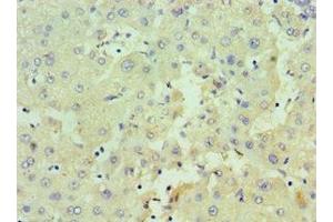 Immunohistochemistry of paraffin-embedded human liver tissue using ABIN7162980 at dilution of 1:100 (HSD17B4 Antikörper  (AA 437-736))