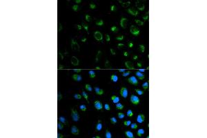 Immunofluorescence analysis of MCF7 cell using FXN antibody. (Frataxin Antikörper)