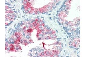 Human Prostate (formalin-fixed, paraffin-embedded) stained with ANXA1at 20 µg/ml followed by biotinylated goat anti-rabbit IgG secondary antibody, alkaline phosphatase-streptavidin and chromogen. (Annexin a1 Antikörper  (N-Term))