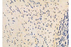 ABIN6261445 and ABIN6278454 at 1/100 staining Mouse brain tissue by IHC-P.