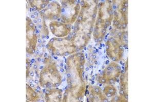 Immunohistochemistry of paraffin-embedded mouse kidney using SPARC antibody (ABIN3022250, ABIN3022251, ABIN1513555 and ABIN6218694) at dilution of 1:100 (40x lens). (SPARC Antikörper  (AA 18-303))