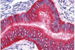 Human Uterus: Formalin-Fixed, Paraffin-Embedded (FFPE) (EpCAM Antikörper)