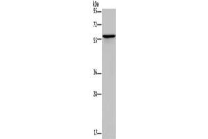 Gel: 10 % SDS-PAGE, Lysate: 40 μg, Lane: Human lung cancer tissue, Primary antibody: ABIN7189699(ADRA1B Antibody) at dilution 1/550, Secondary antibody: Goat anti rabbit IgG at 1/8000 dilution, Exposure time: 1 minute (ADRA1B Antikörper)