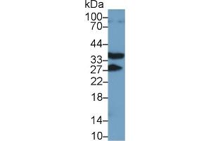 Detection of RANk in Mouse Kidney lysate using Polyclonal Antibody to Receptor Activator Of Nuclear Factor Kappa B (RANk) (TNFRSF11A Antikörper  (AA 330-615))