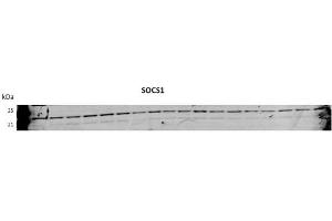 SOCS1 antibody - N-terminal region  validated by WB using Huh7 Cells transfected with microRNA at 1:1000. (SOCS1 Antikörper  (N-Term))