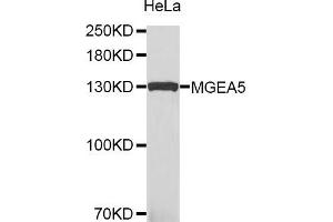 Western blot analysis of extracts of HeLa cells, using MGEA5 antibody. (MGEA5 Antikörper)
