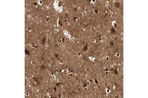 Immunohistochemical staining (Formalin-fixed paraffin-embedded sections) of human cerebral cortex with MT3 polyclonal antibody  shows strong nuclear and cytoplasmic positivity in neuronal cells and glial cells.