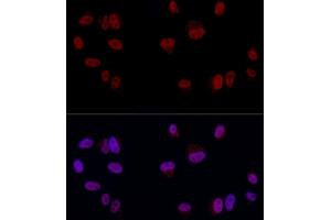 Immunofluorescence analysis of A-549 cells using YE Rabbit pAb (ABIN6130808, ABIN6150331, ABIN6150332 and ABIN6221925) at dilution of 1:50 (40x lens). (GAS41 Antikörper  (AA 1-227))
