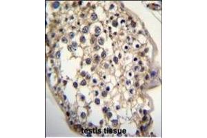 Immunohistochemistry (Paraffin-embedded Sections) (IHC (p)) image for anti-7-Dehydrocholesterol Reductase (DHCR7) (AA 437-463), (C-Term) antibody (ABIN655399)