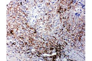 Immunohistochemistry (IHC) image for anti-Lymphotoxin beta Receptor (TNFR Superfamily, Member 3) (LTBR) (AA 420-435), (C-Term) antibody (ABIN3044034)