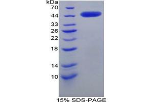 SDS-PAGE analysis of Rat CRH Protein.