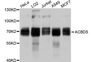 Western blot analysis of extracts of various cell lines, using ACBD5 antibody. (ACBD5 Antikörper)