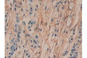 Immunohistochemistry (IHC) image for anti-CD90 (THY1) (AA 20-133) antibody (ABIN7437497)