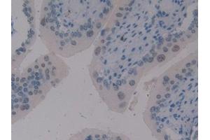Detection of ELOA in Mouse Vas Deferens Tissue using Polyclonal Antibody to Elongin A (ELOA) (TCEB3 Antikörper  (AA 76-345))