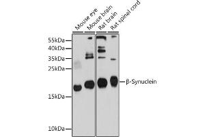 Western blot analysis of extracts of various cell lines, using β-Synuclein antibody (ABIN6127517, ABIN6148193, ABIN6148194 and ABIN6214698) at 1:1000 dilution. (beta Synuclein Antikörper  (AA 1-134))