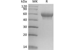 Western Blotting (WB) image for Interleukin 6 Receptor, alpha (IL6RA) protein (His tag) (ABIN7320911) (IL6RA Protein (His tag))