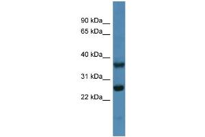 WB Suggested Anti-Atp5f1 Antibody Titration: 0. (ATP5F1 Antikörper  (N-Term))